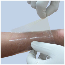 Universe Surgical Collagen Film Dressing