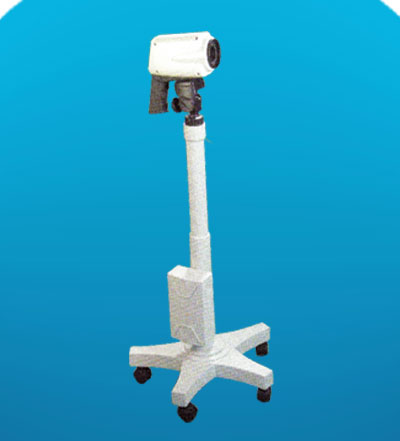 Video Colposcope