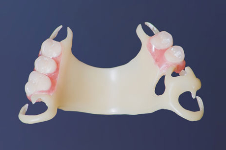 Flexible Dentures