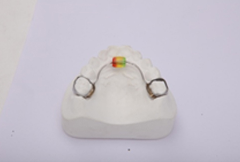 Removable Tongue Trainer With Bead