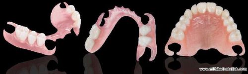 Flexible Denture