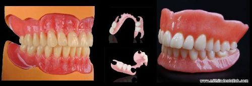 MDS DENTURE