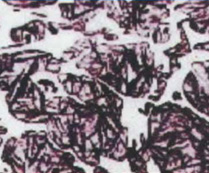 Alloy Indefinite Chill Rolls