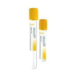 Gel and Clot Activator Tube