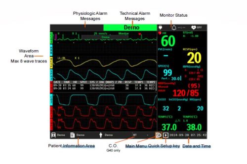 Philips Goldway Patient Monitoring System