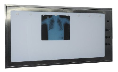 X-ray Film Viewer