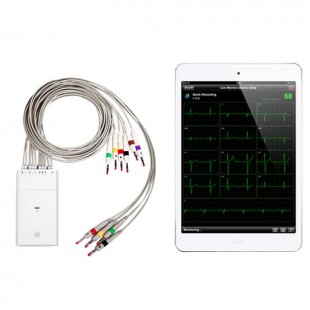 ECG Monitoring