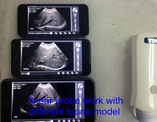 Linear Probe Wireless Ultrasound Scanner