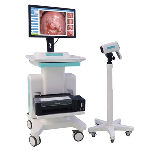 Automatic Polished Digital Colposcope, For Clinic, Hospital, Feature : Adjustable, Colposcopy Software