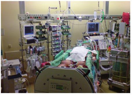 Intensive Care Unit, For Hospital