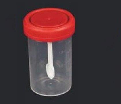 Stool Sample Container, Capacity : 15 Ml