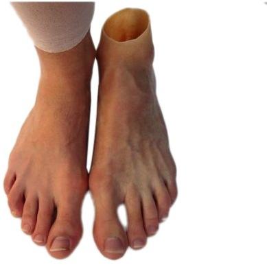 Silicone Foot Prosthesis