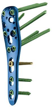 Philos System, Orthopedic Implant Tools