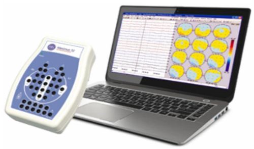 Portable EEG Machine, Color : Blue, Green, Grey, Pink, White, Yellow, Shiny-silver, Silver