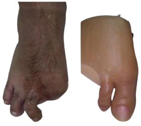 Silicone Artificial Foot Finger, Color : Skin Color