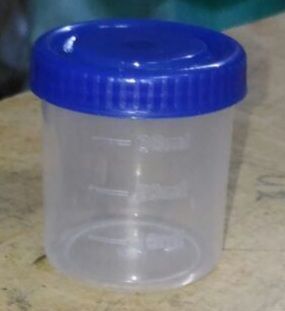 Polypropylene Plain 30 ML Urine Container, For Hospital, Laboratory, Clinic