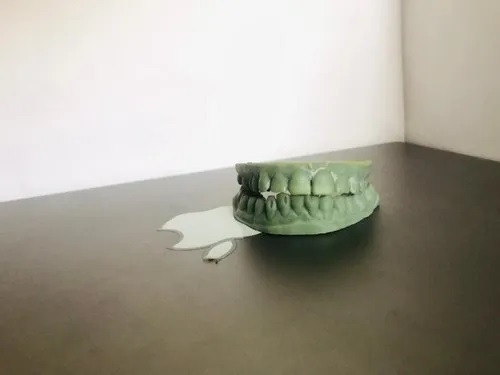 Resin Dental Treatment Services, Color : Gray