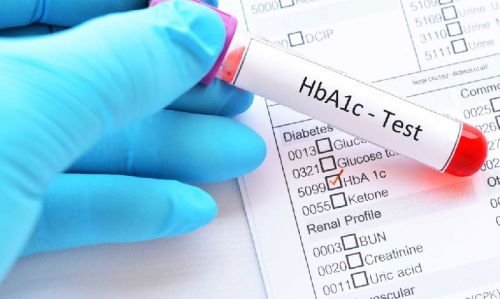 Hba1c Test Service