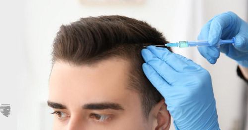 Hair Transplantation