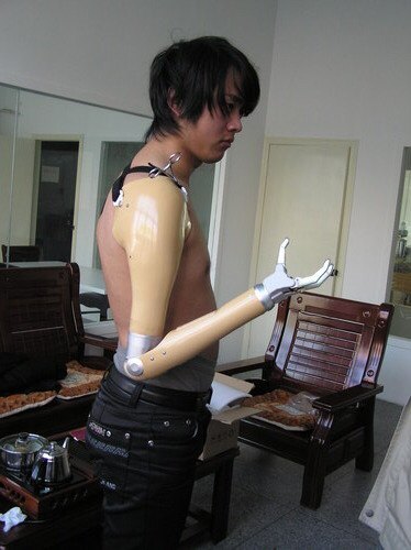 Elbow Prosthesis, Color : Skin Color