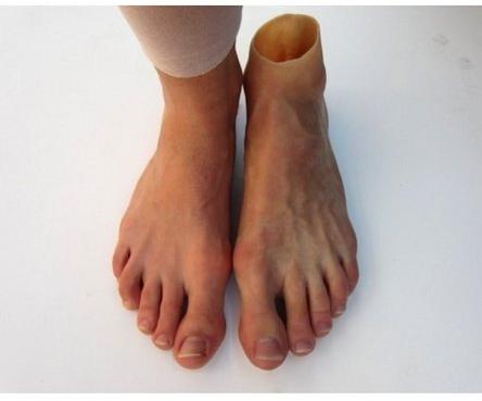 Silicone Foot Prosthesis