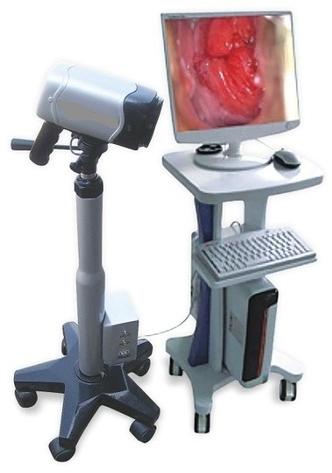 Polished Digital Colposcope, Feature : Adjustable, Colposcopy Software, High End