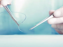 Medical Sutures