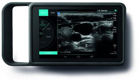 SonoSite Ultrasound Machines