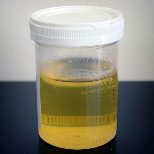 Distilled Cow Urine, For Medicine Use, Form : Liquid