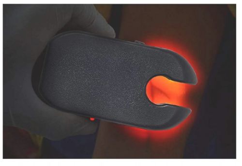 Electric 50 Hz Vein Finder, Display Type : Digital Display, LED