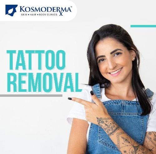 Tattoo Removal