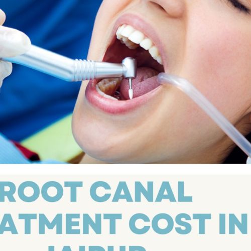 Dentel Seva Dental Service