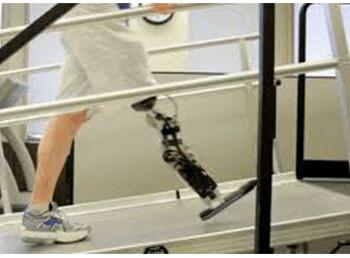 BELOW KNEE BIONIC LEG
