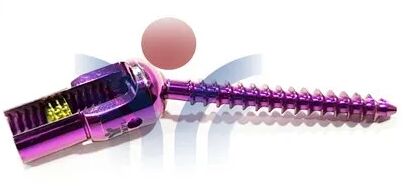 Titanium Poly Axial Screw, Color : Black