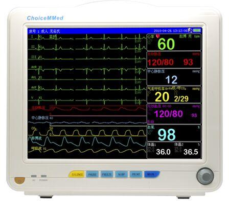 Patient Monitor