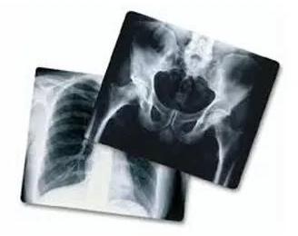 Carestream Kodak Dental X Ray Films