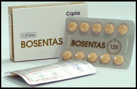 Bosentas Tablets