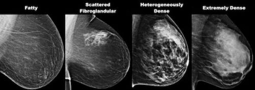 Mammography Test Service