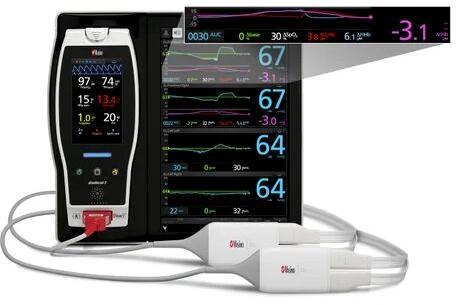 Nirs Monitor