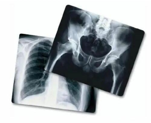 X Ray Films for Hospital, Clinic, etc