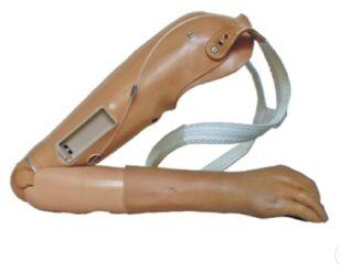 College Park Elbow Prosthesis