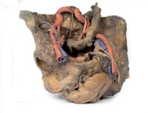 Female Pelvis Deep Dissection 3d Anatomical Model