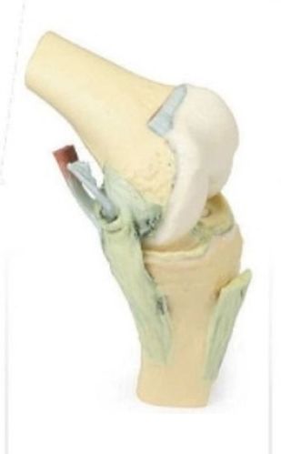 Knee Joint Flexed 3D Anatomical Model, For School, Science Laboratory, Feature : Accurate Design, Crack Proof