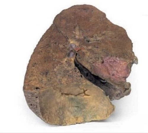 Lung Slab Hilum 3D Anatomical Model, For School, Science Laboratory, Feature : Accurate Design, Crack Proof