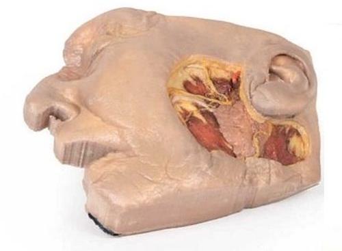 Parotid Gland and Facial Nerve Dissection 3D Anatomical Model
