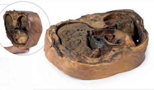 Thoracic Cross Section T6 3D Anatomical Model