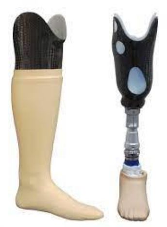 Aluminium Carbon Fibre Polished Amputees Prosthesis