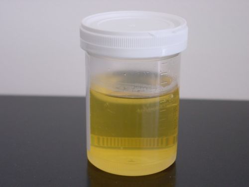 Yellow Donkey Urine