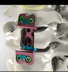 Medafer Gray Crepe Bandage, Size : 4 Mtr, 4 Mtr, 4 Mtr