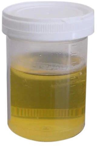 Dark-Yellow Liquid Pure Cow Urine, For Clinical Use, Personal Use, Purity : 99%